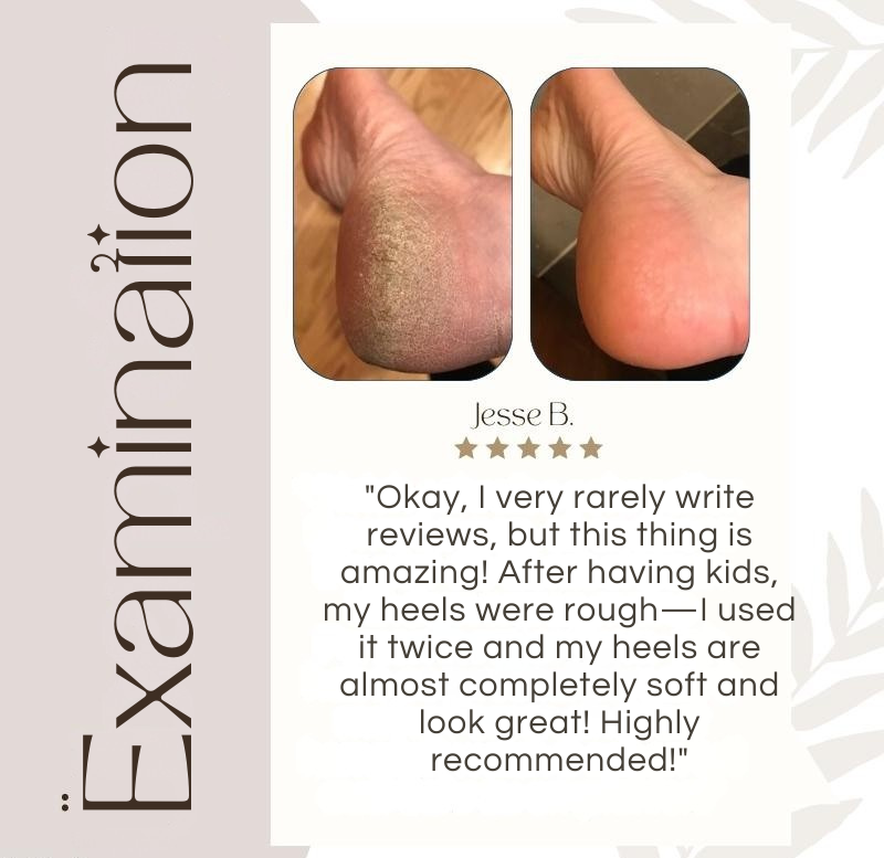 Rechargeable Waterproof Callus Remover with Quartz Crystal Rollers