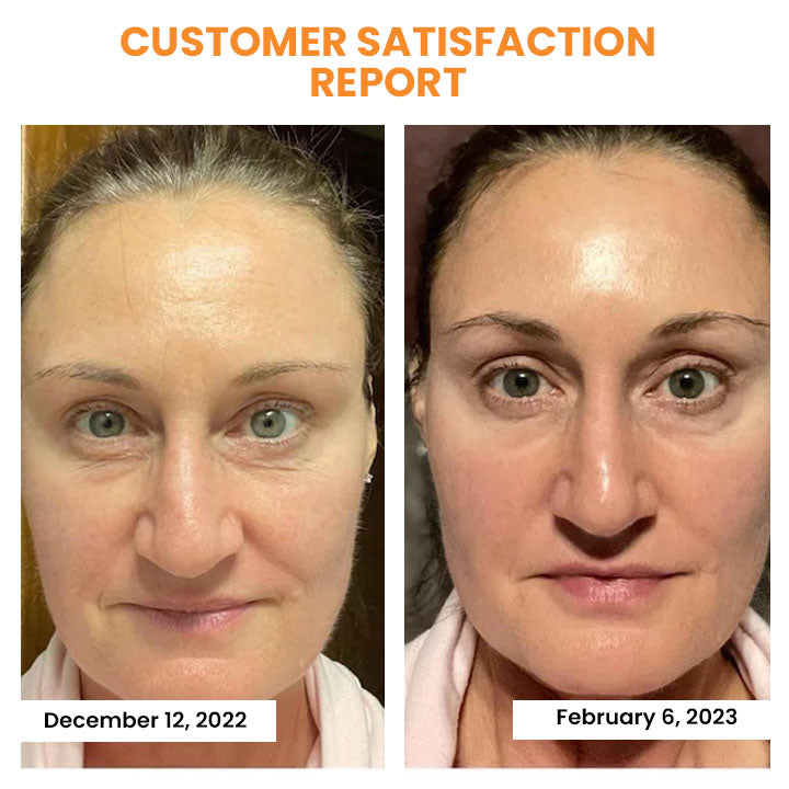 Soluble Collagen Film with Korean Dermalayer Technology
