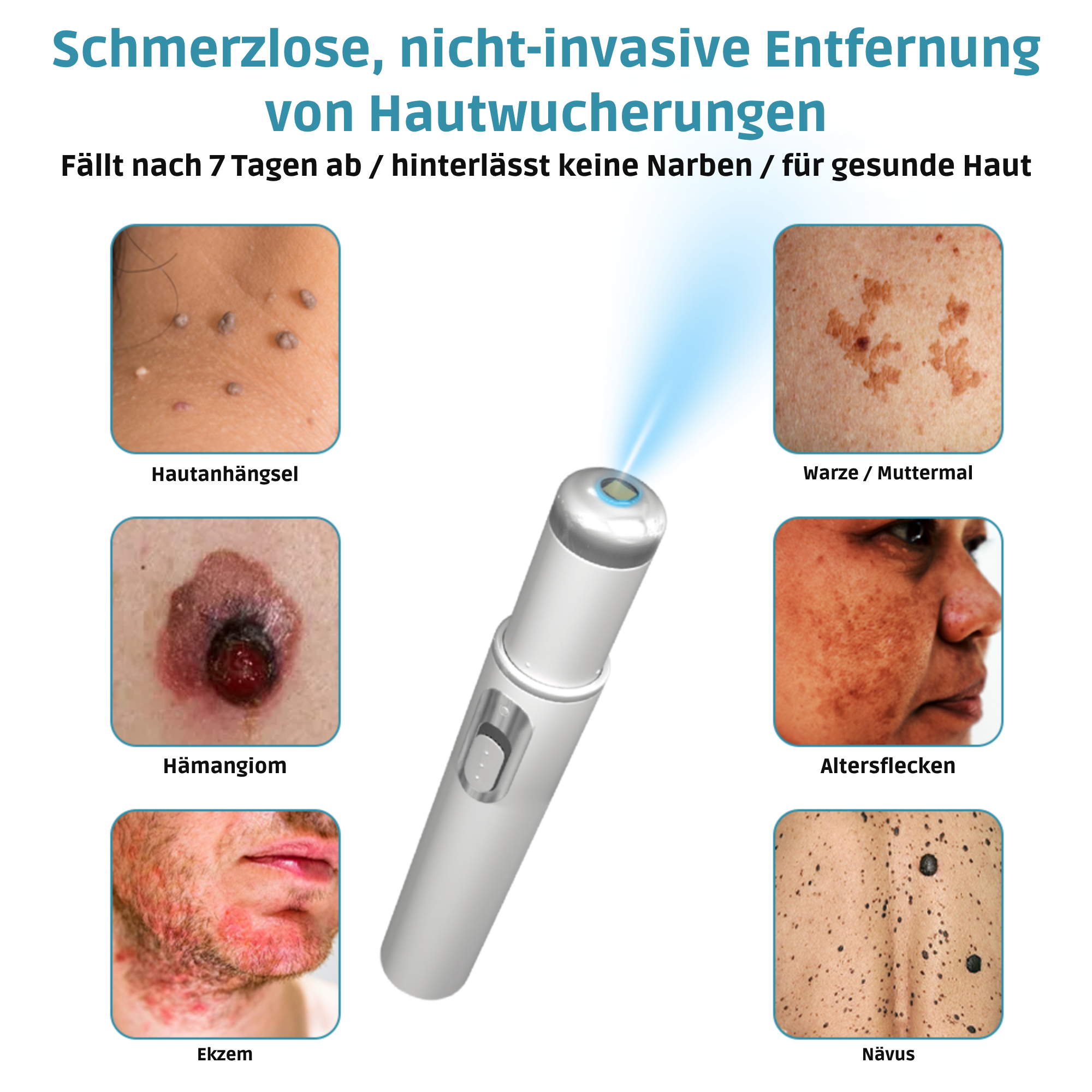 Painless Laser Pen for Flawless Skin and Confidence Anytime