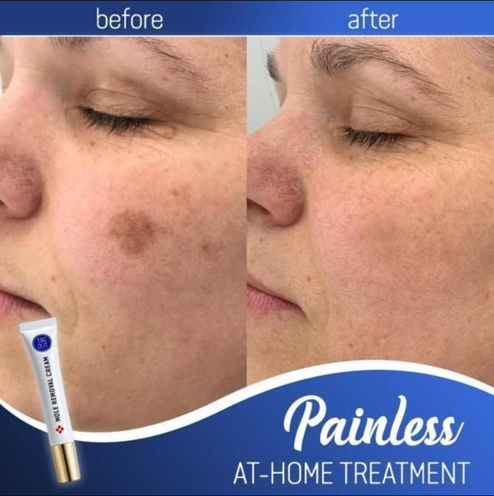 Radiance Cream - Achieve Glowing Skin