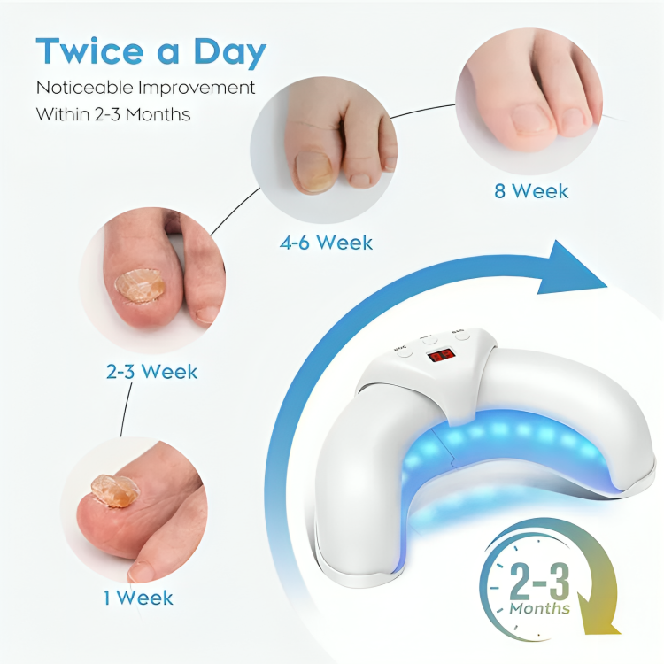 Nail Fungus Treatment | Combat and Eliminate Nail Infection
