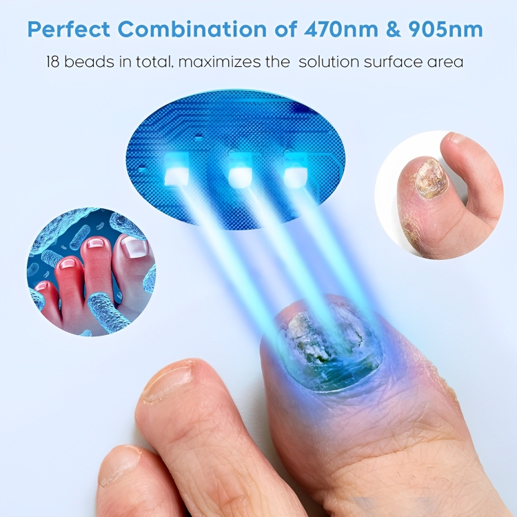 Nail Fungus Treatment | Combat and Eliminate Nail Infection