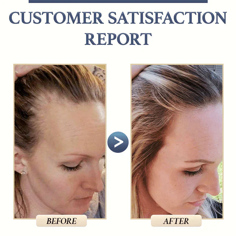 Natural Hair Growth Shampoo | Reduces Hair Loss | Gentle Scalp Care