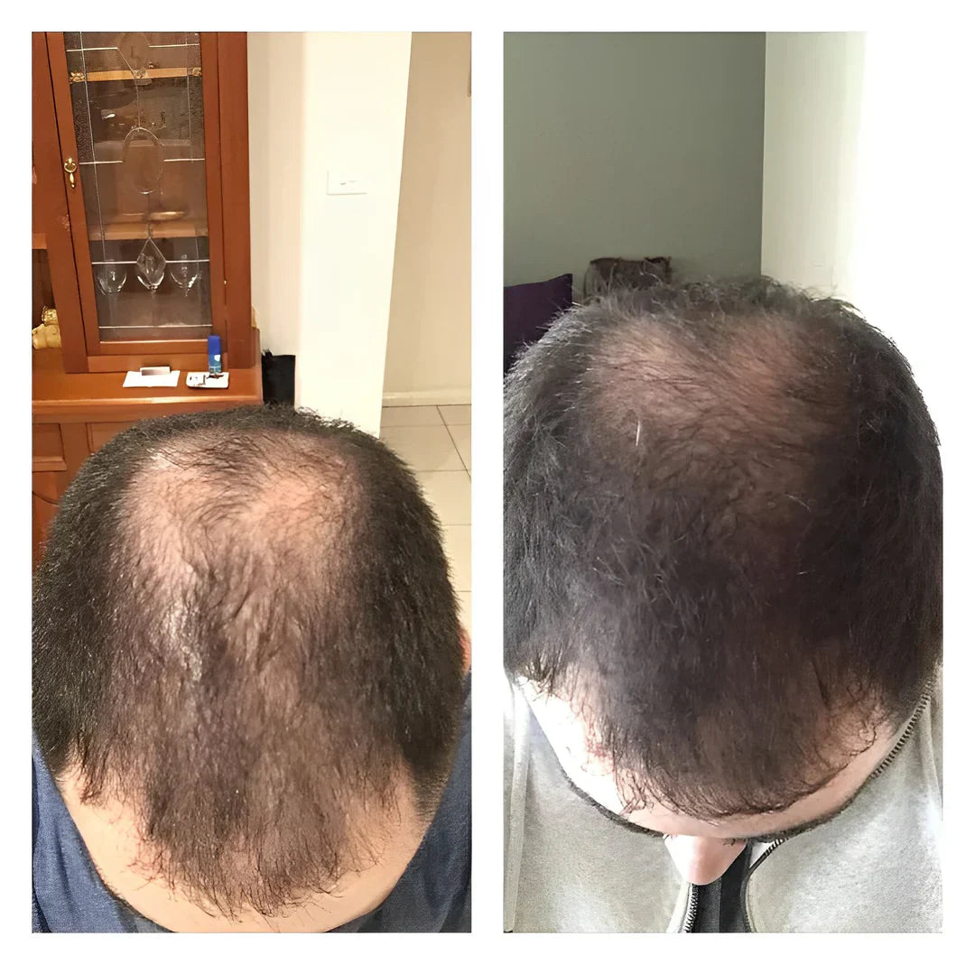 Natural Hair Growth Shampoo | Reduces Hair Loss | Gentle Scalp Care