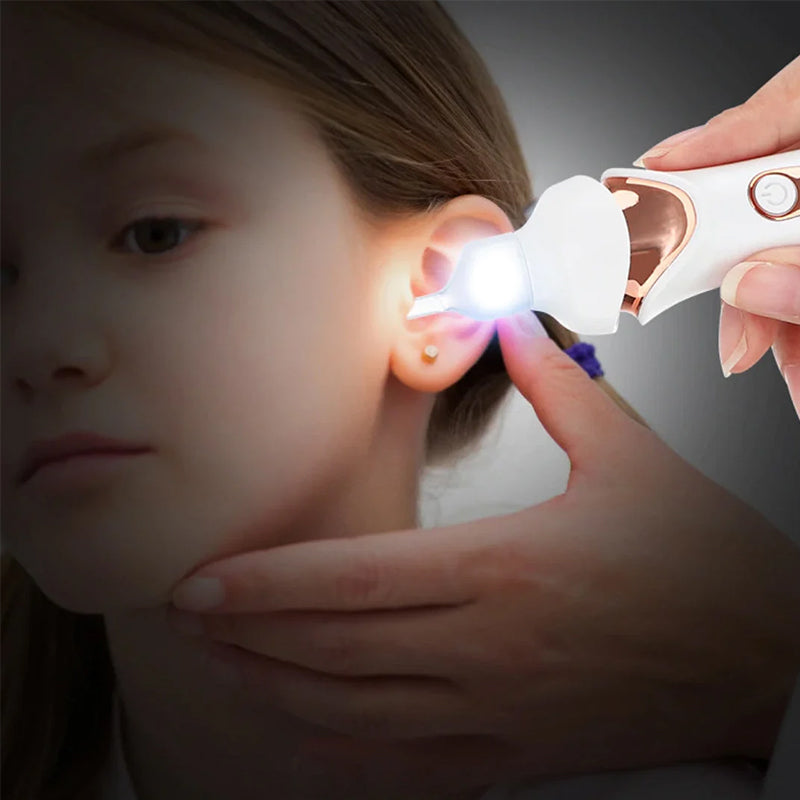 Silicone Tip Earwax Remover | Gentle Ear Cleaner | Rechargeable via USB