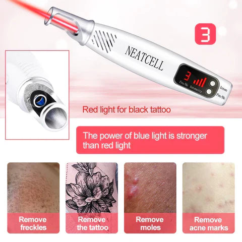 Home Laser Solution for Tattoo and Skin Blemish Removal