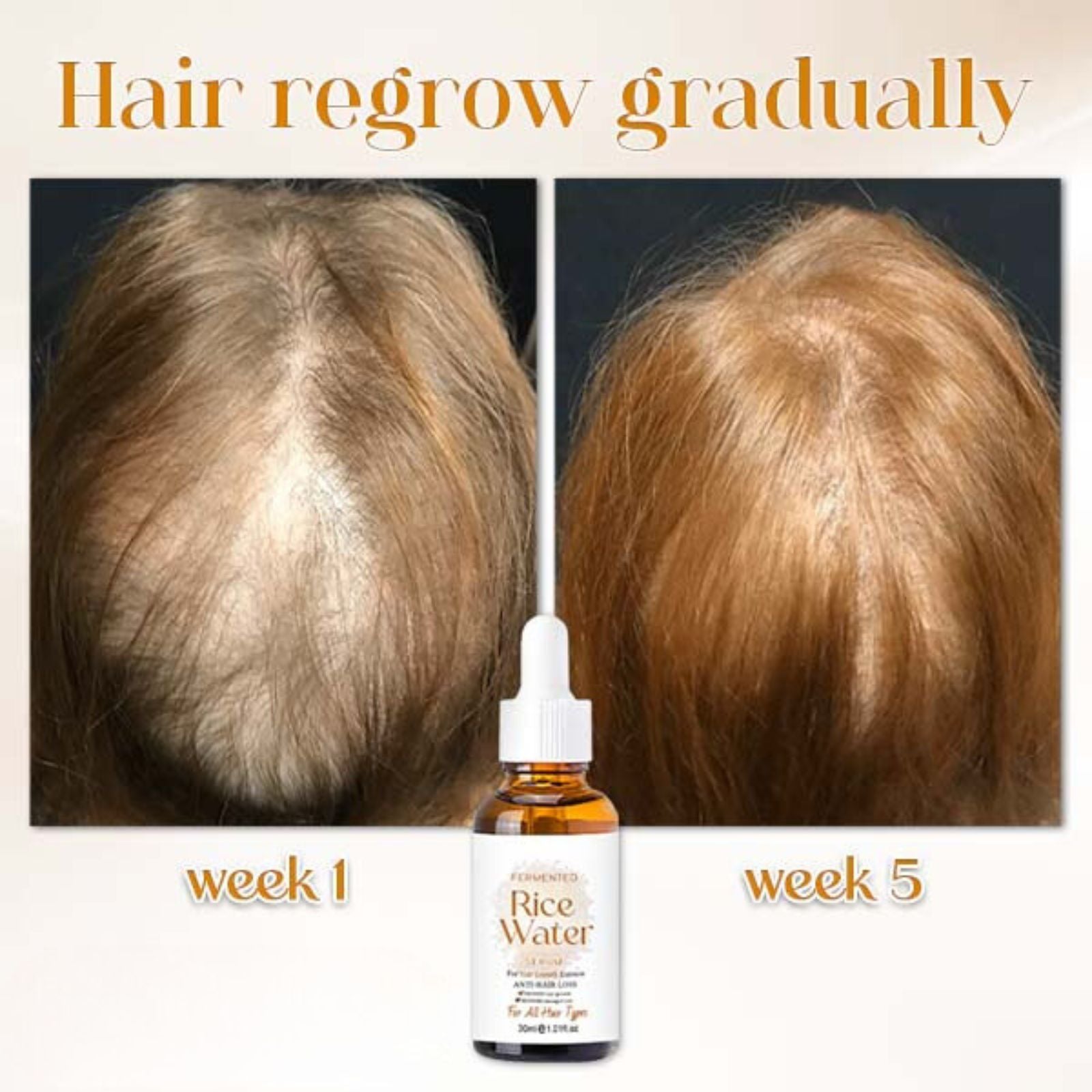 Japanese Fermented Rice Water Hair Serum for Pore Care