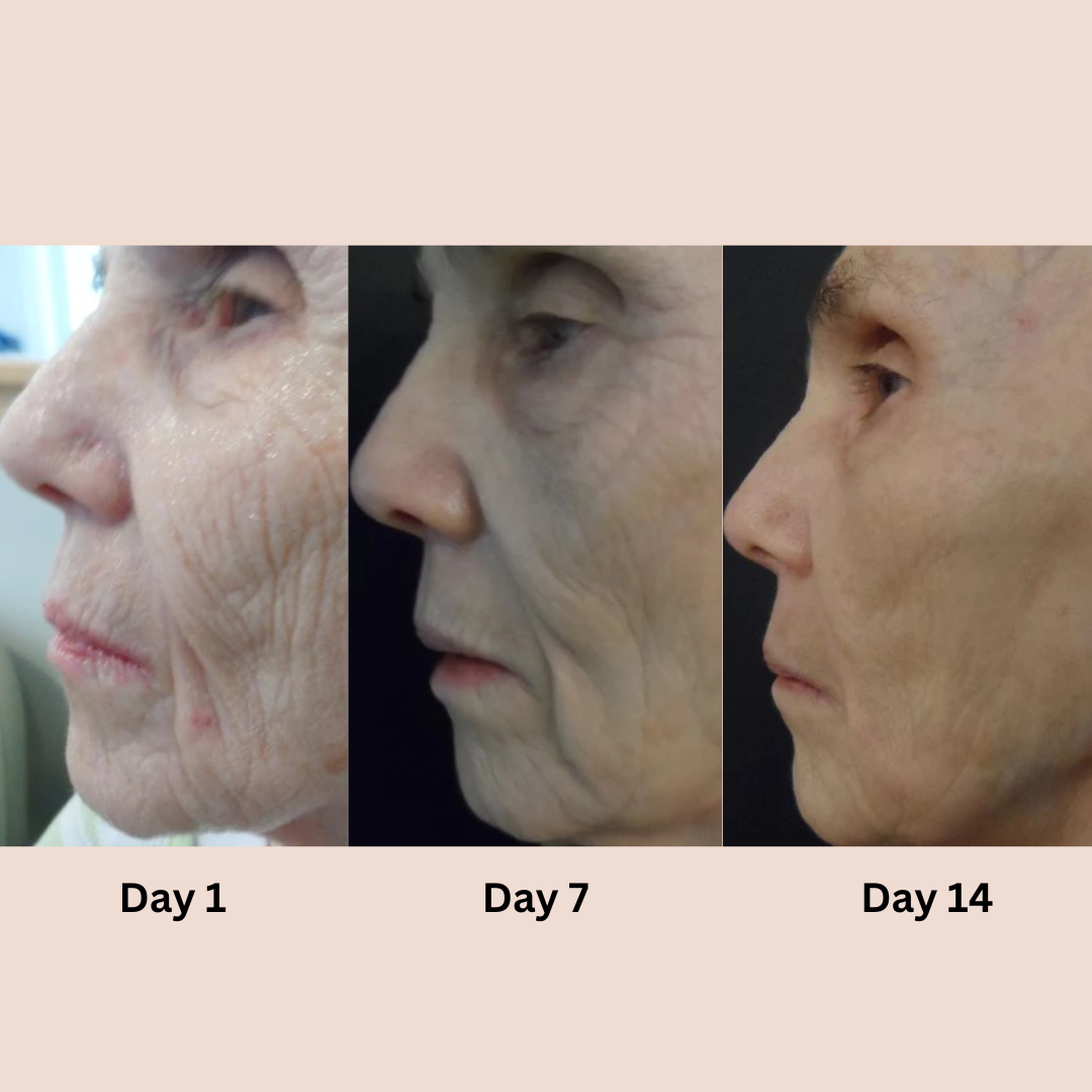 Revitalize Your Eyes for a Youthful Appearance!