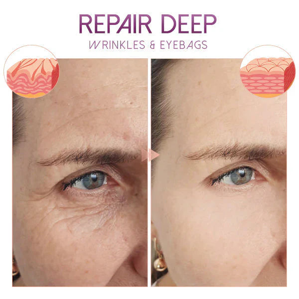Revitalize Your Eyes for a Youthful Appearance!