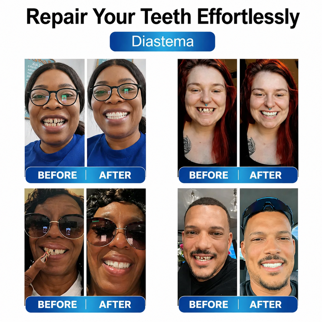 Denture Repair Kit with LED Light | Malleable Tooth Gel
