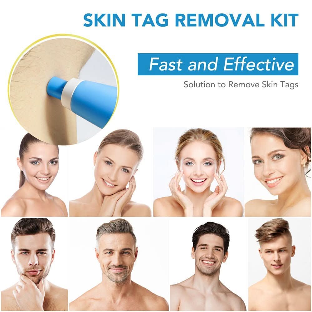 Skin Spot Remover Tool – Simple and Effective Care Solution