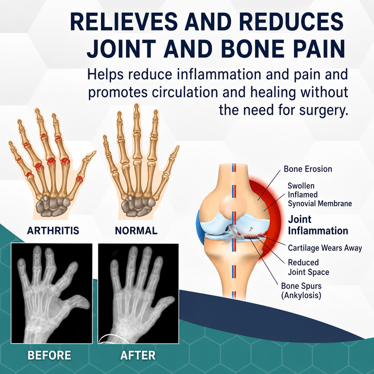 Pain Relief | Bee Venom Joint Care | Deep Heat Massage Treatment
