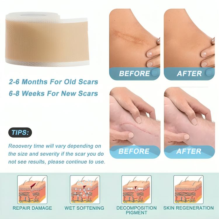 Silicone Scar Sheets for Skin Repair