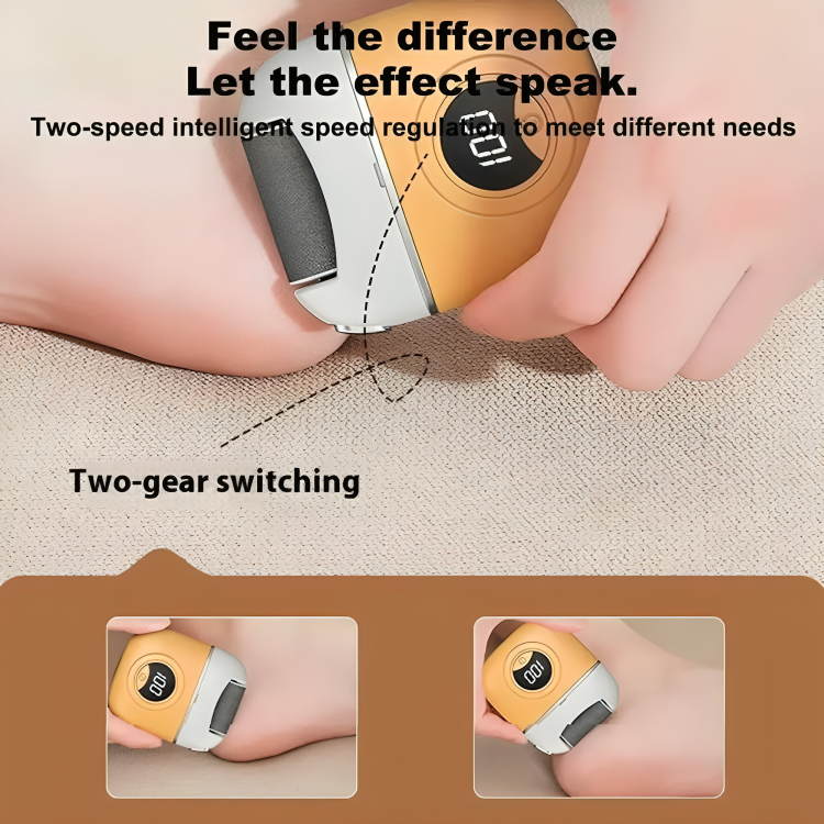 SoleGlow | Say Goodbye to Rough, Dry Heels!