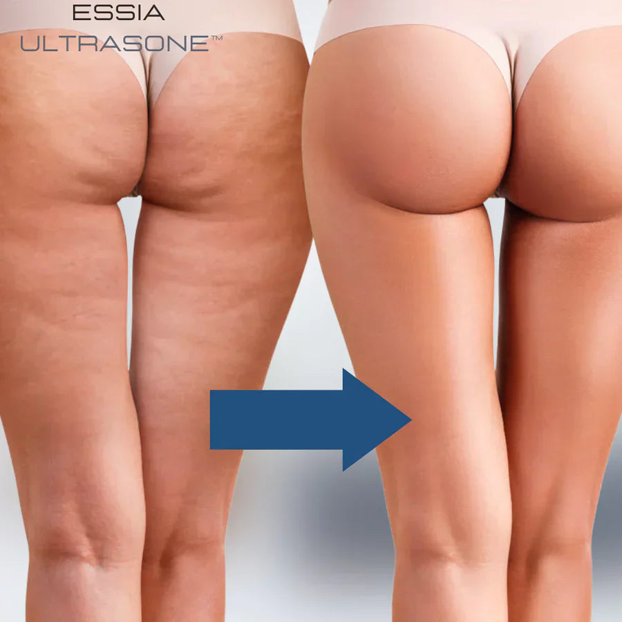 Quickly Tone and Tighten Your Body!