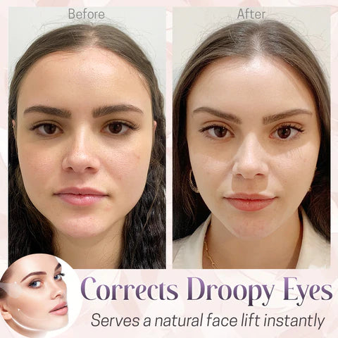 Invisible Face Lifting Strap