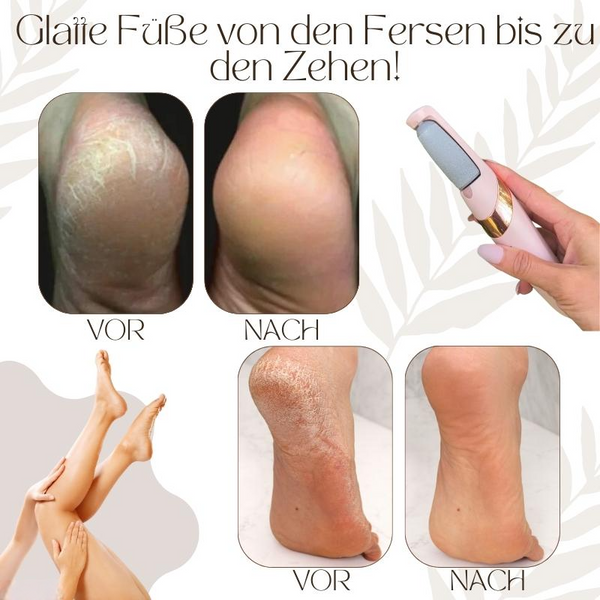 Show Off Your Soft Feet with VelvetStep Foot Care