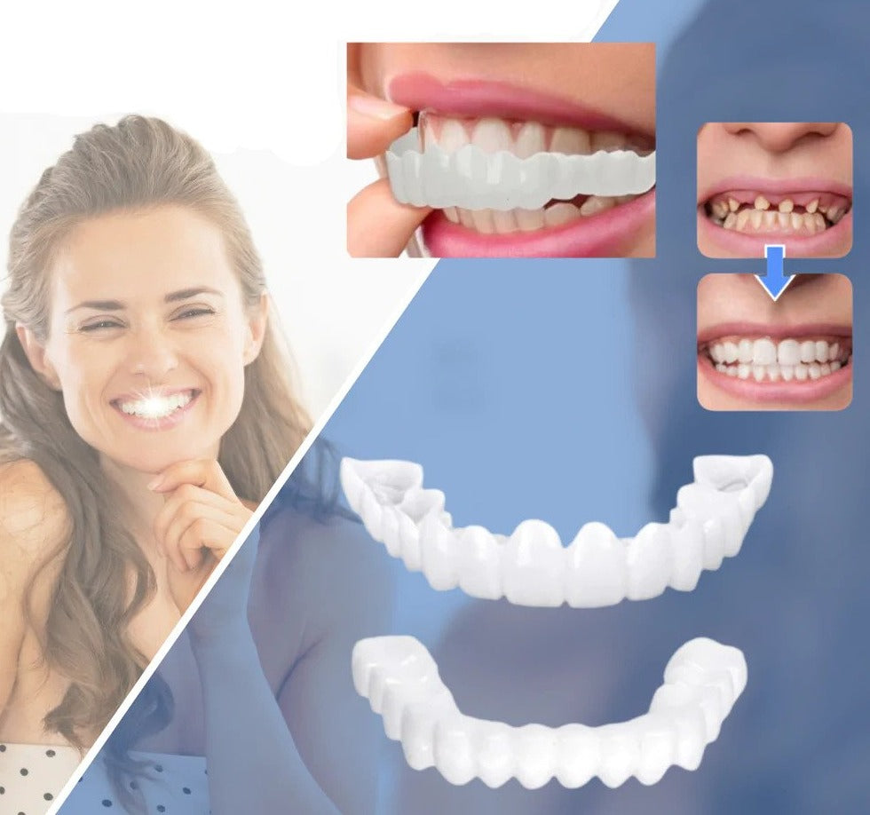 Flexible Fit Veneers without Adhesive for Eating, Drinking, and Daily Use