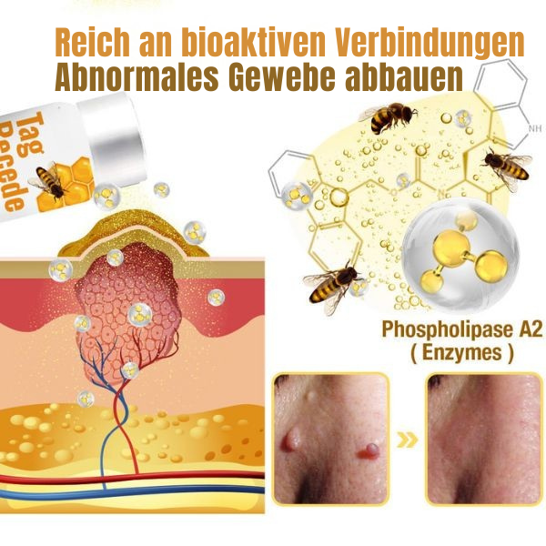 Wart Removal Spray with Bee Venom Formula - Pain-Free Solution