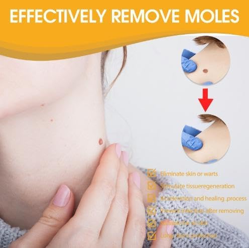 Wart Remover | Targeted Skin Spray | Bee Venom Care Formula