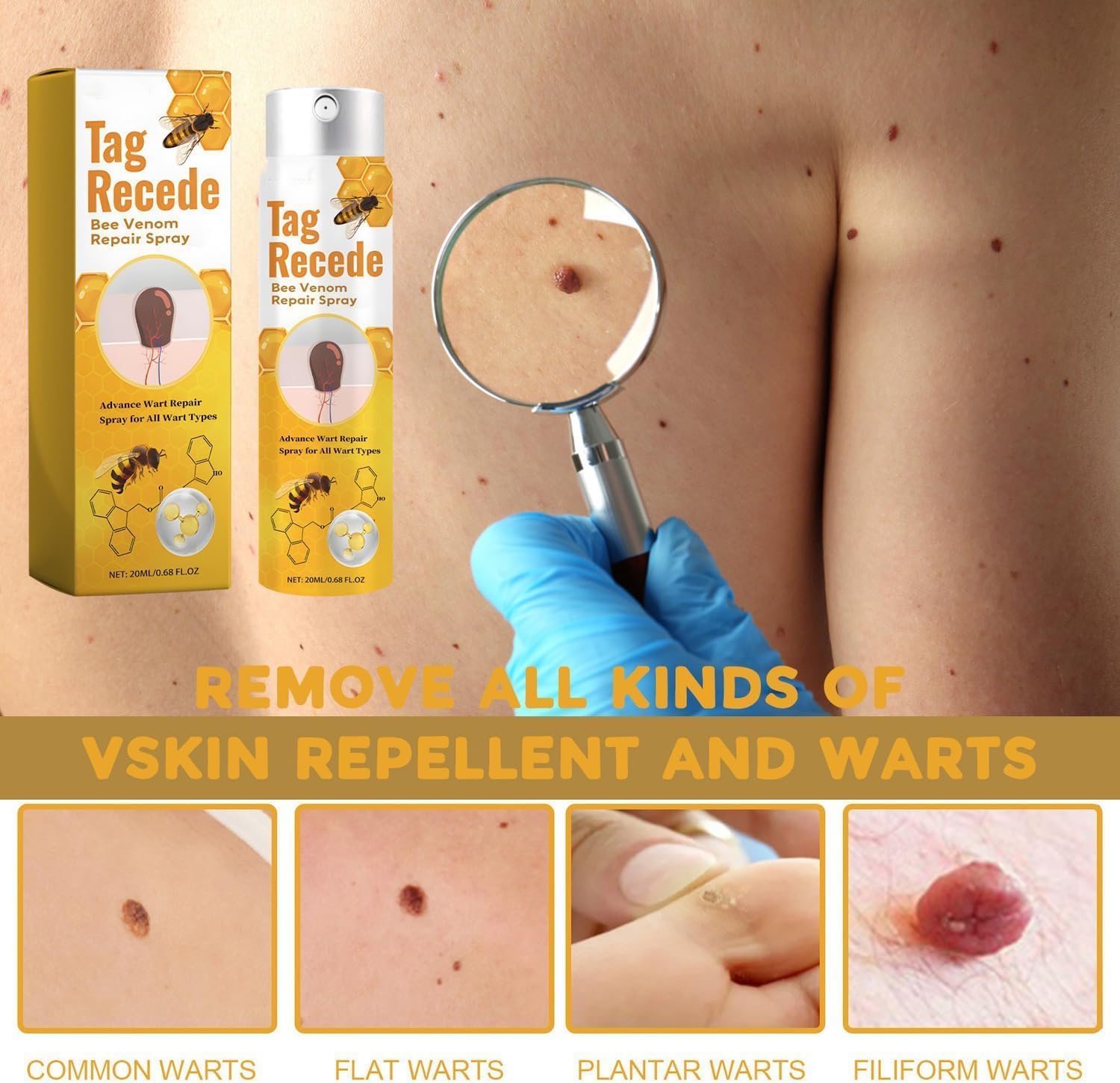 Wart Remover | Targeted Skin Spray | Bee Venom Care Formula