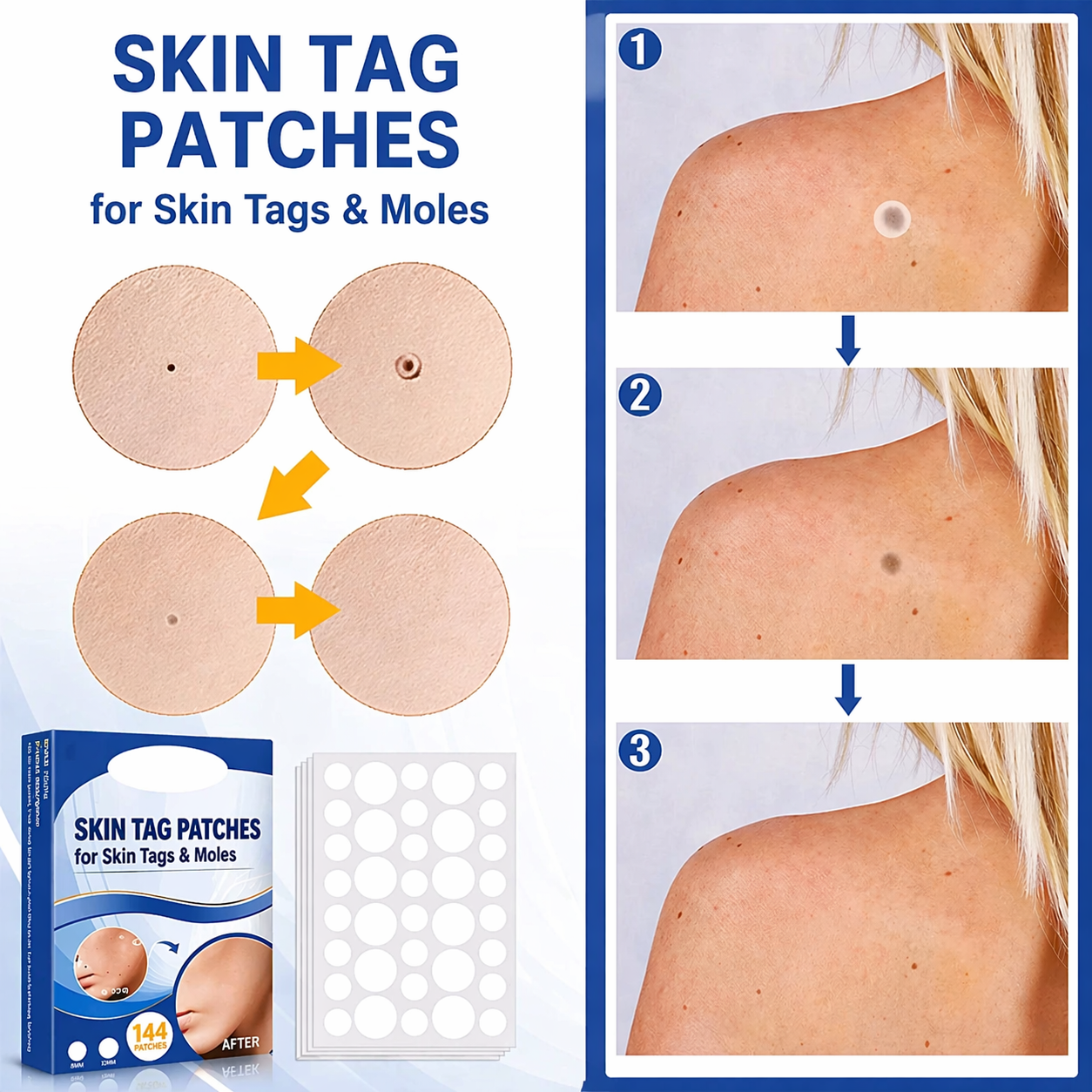 Wart Removal Patches | Discreet Skin Adhesives for Gentle Home Care