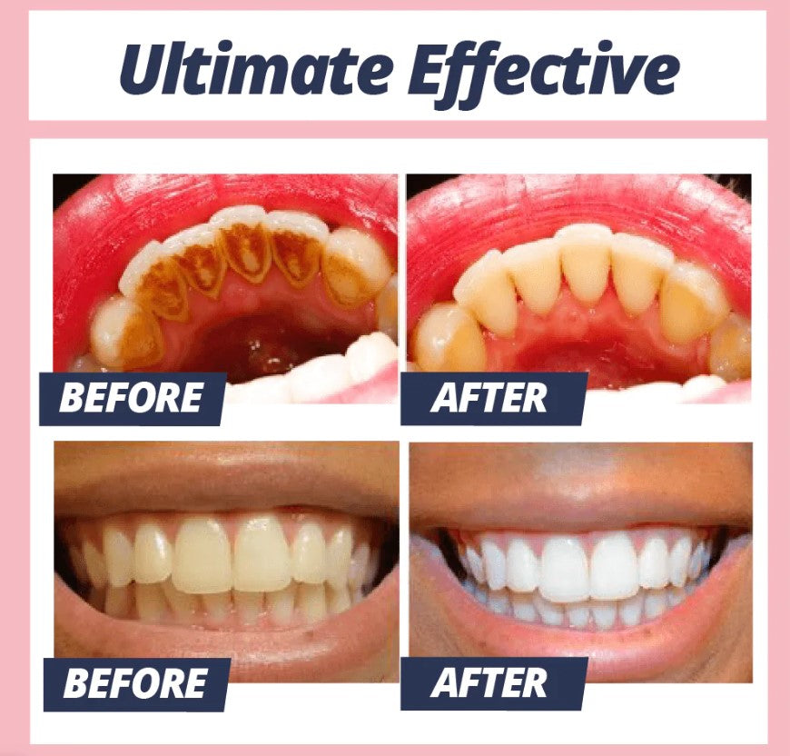 Teeth Whitening | Stain Removal Toothpaste | Gentle Baking Soda Cleanser