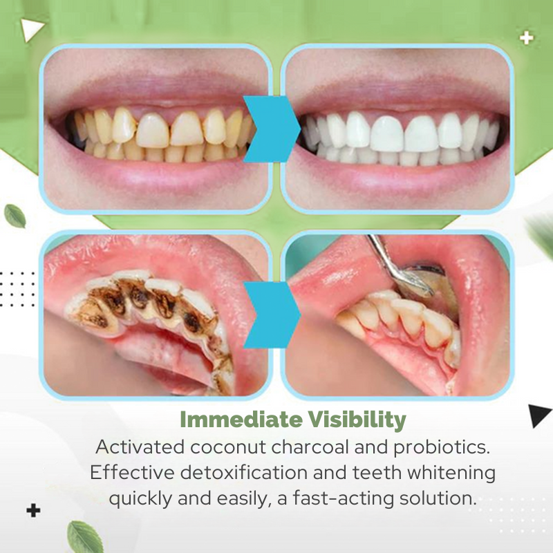 Teeth Whitening and Tartar Removal with Natural Ingredients