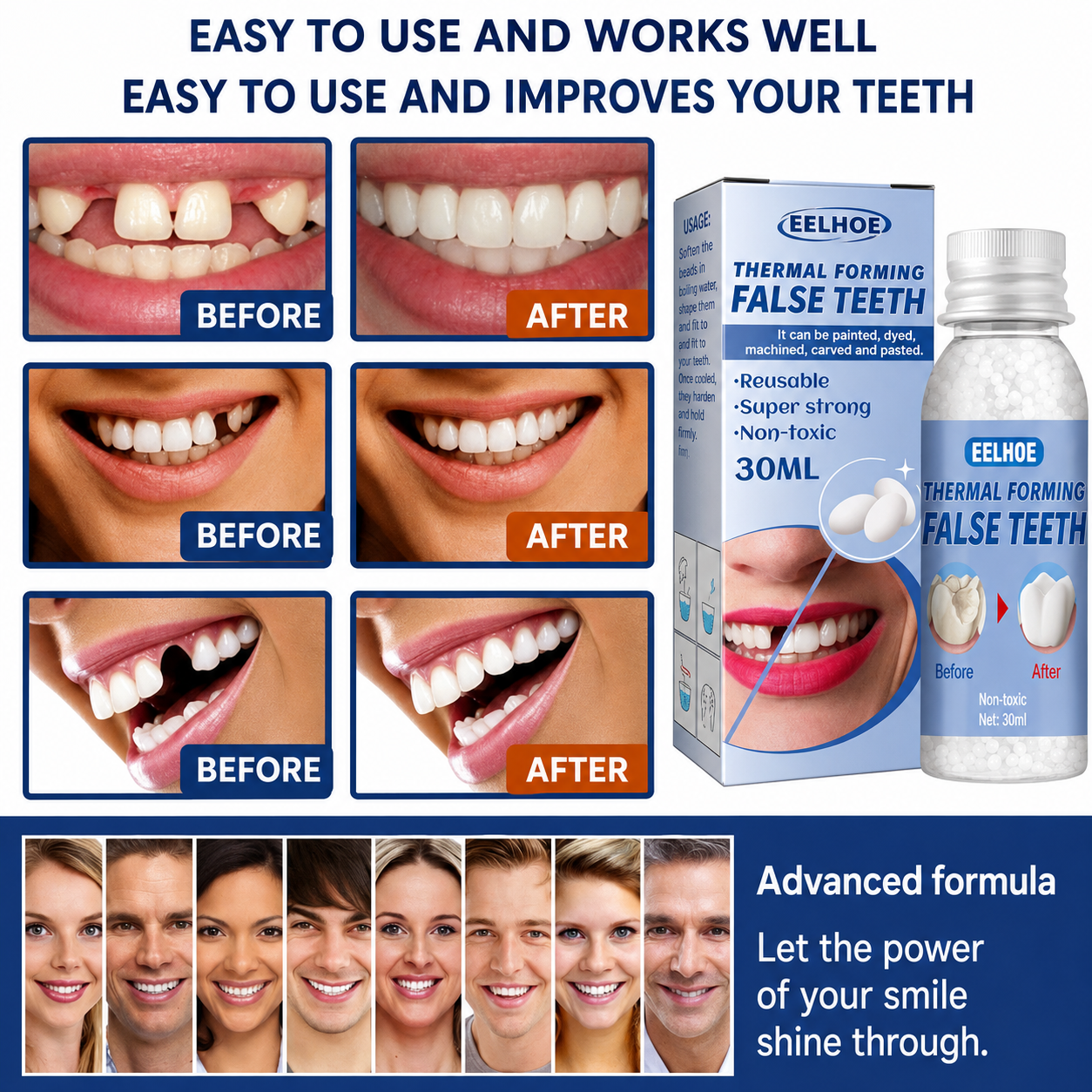 Dental Care | Tooth Repair Kit | Instant Filling for Cavities