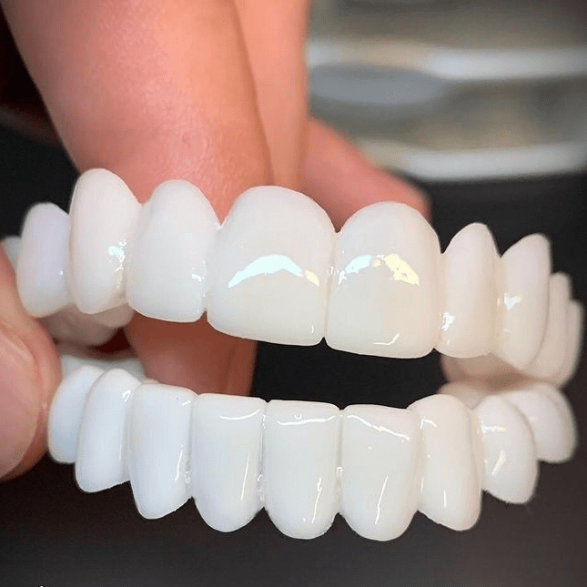 Stylish Dental Enhancer with Bright White Lenses