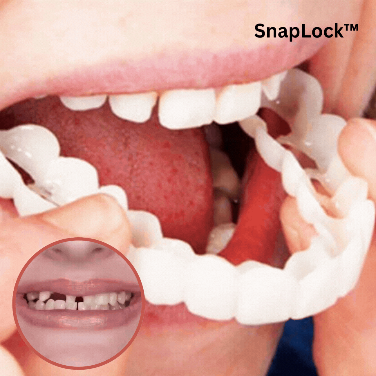 RamoraDent™ — Snap On Your Perfect Smile and Own Every Moment