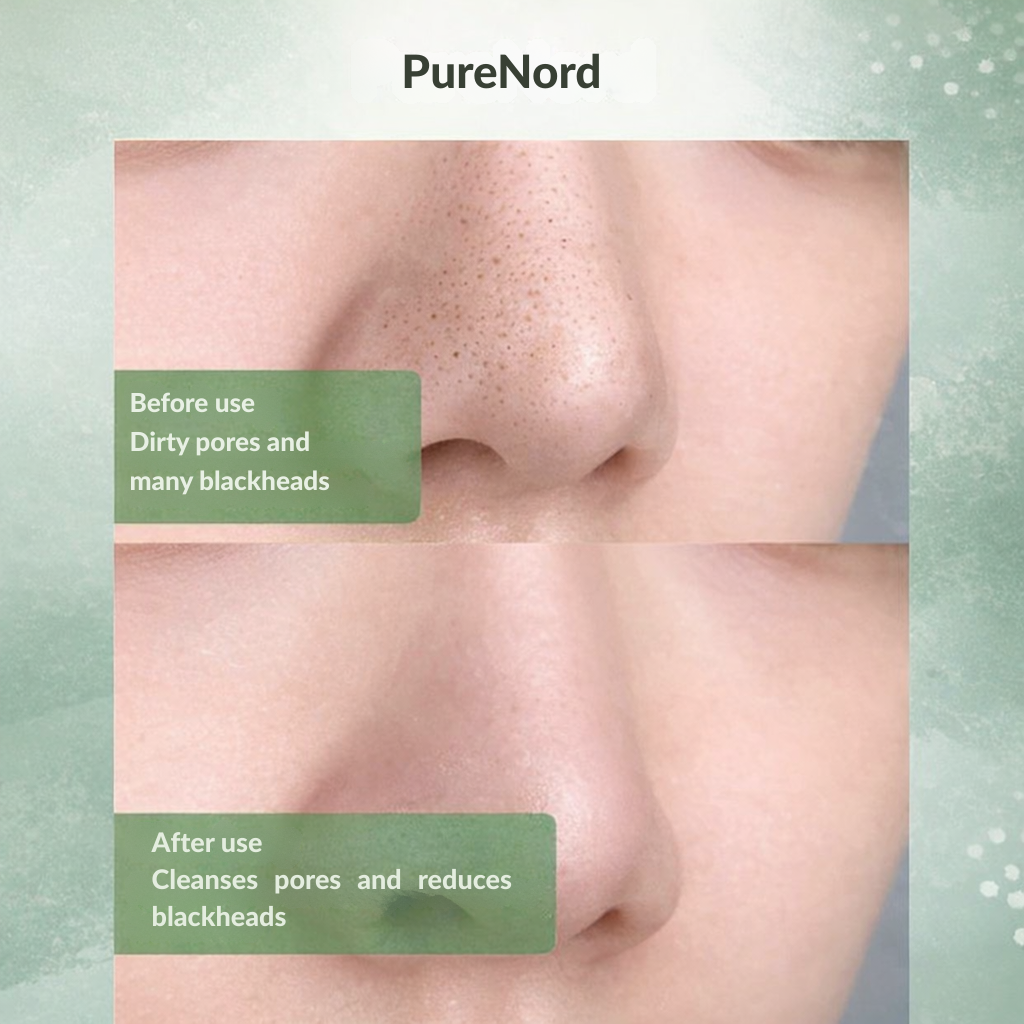 VitaDew™ Solid Cleanser — Unlock Clear, Calm Skin That Glows All Day