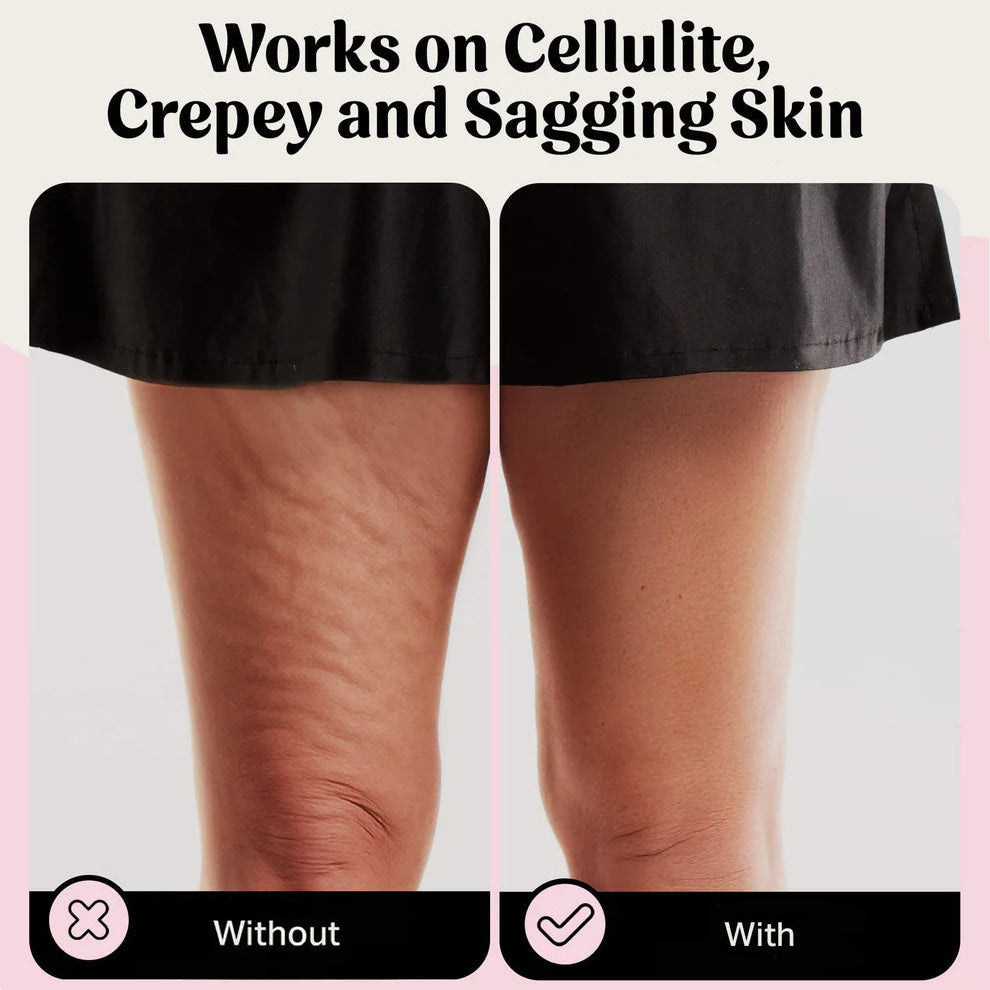 VellaShape™ Body Tape — Instantly Lift and Smooth Your Curves for Unstoppable Confidence