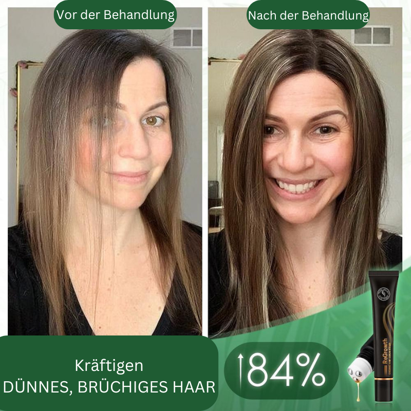 VitaStrand™ — Ignite Dormant Follicles for Naturally Fuller, Head-Turning Hair