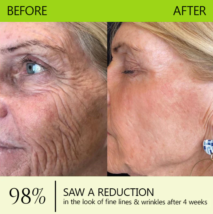LysoriaLift™ — Reveal Firmer, Radiant Skin That Turns Back Time Without Needles