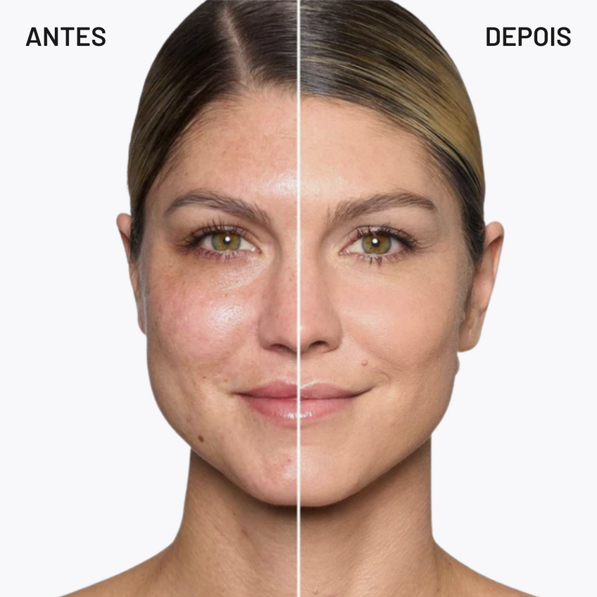 RamoraLuxe™ — Unlock Your Skin’s Radiant, Flawless Confidence Every Day