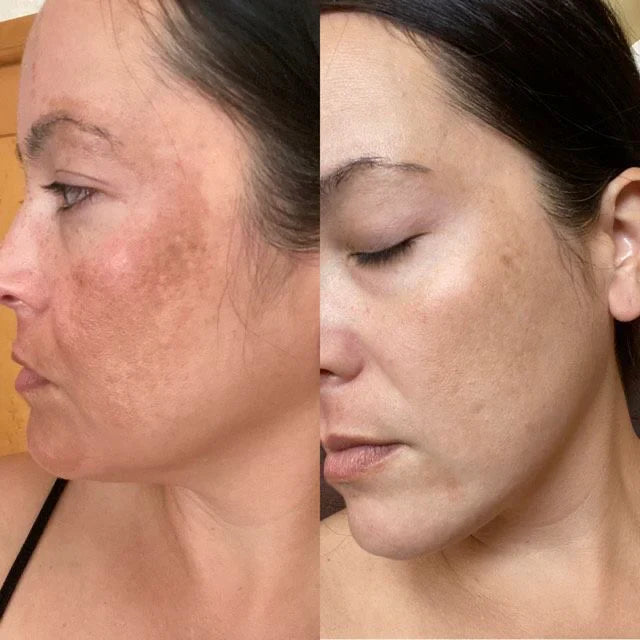 LumiLuxe™ — Unlock Your Glow with Youthful, Radiant Skin Every Day