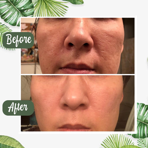 PoreVive™ Detox Mask Stick — Reveal Fresh, Shine-Free Skin That Commands Attention