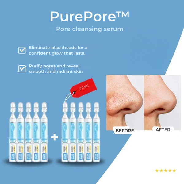 ClariSkin™ — Banish Blackheads and Unleash Radiant, Touchably Smooth Skin
