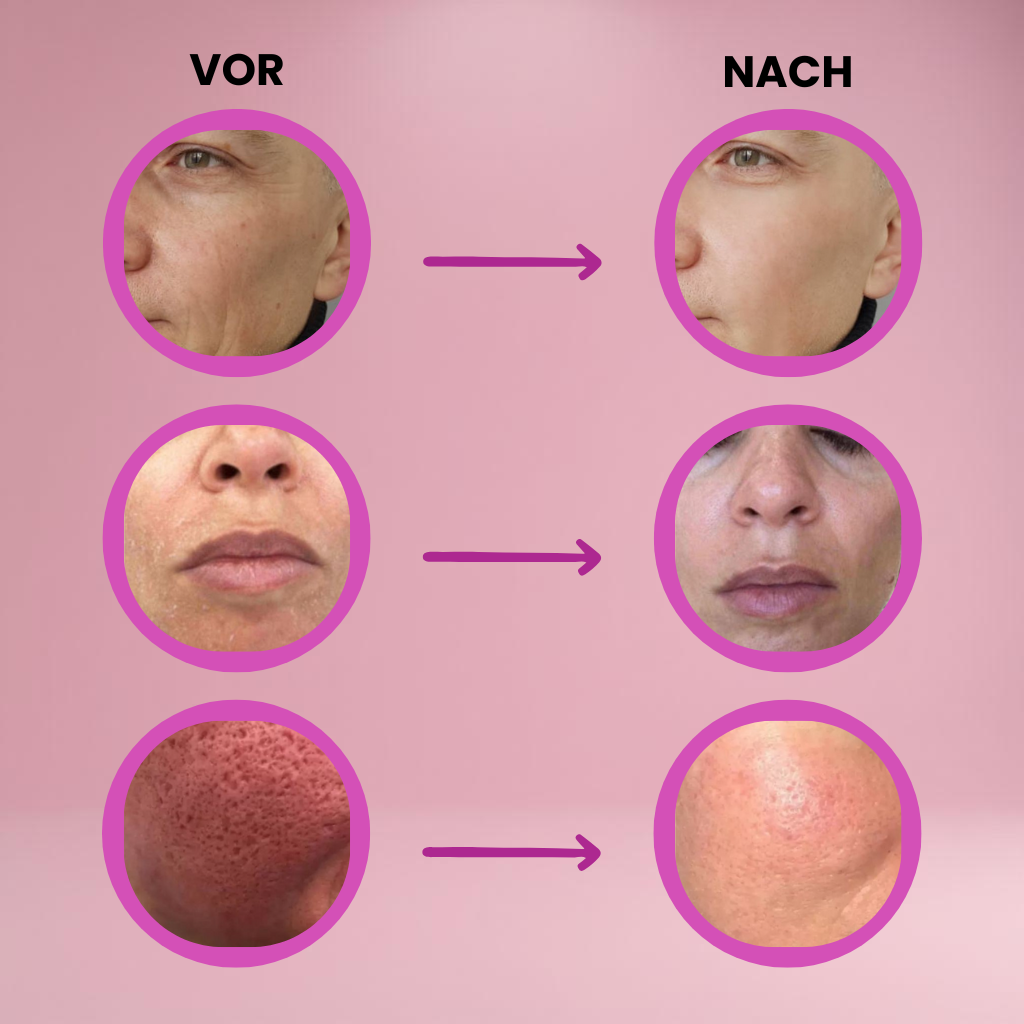 RadianceWave™ — Ignite Your Glow and Erase Years in Seconds