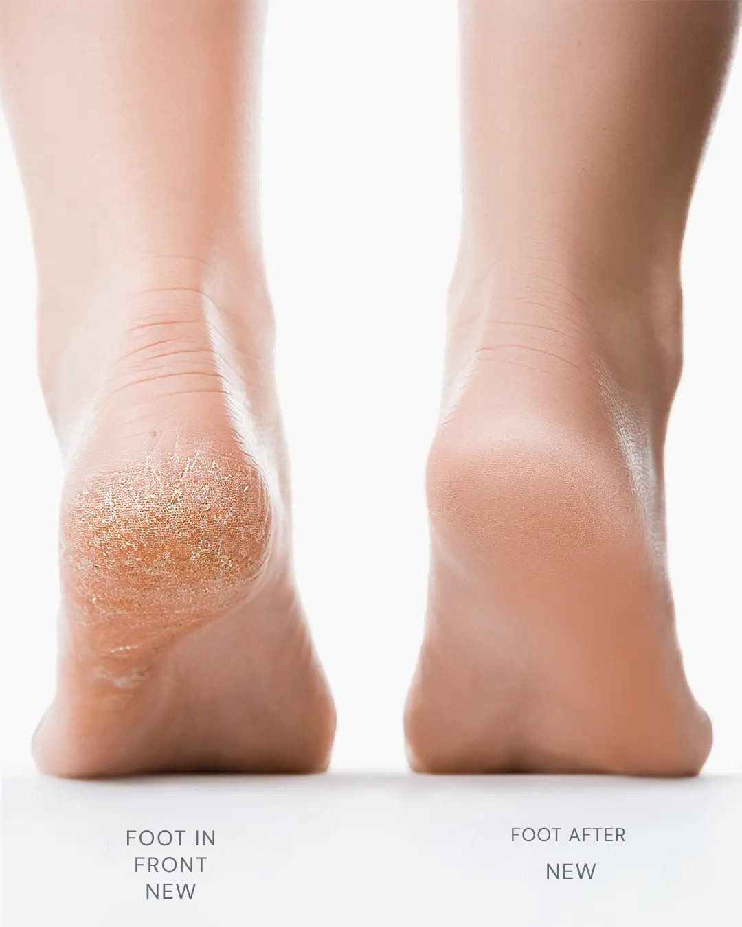 SolavaSmooth™ — Effortless, Silky Feet That Boost Your Barefoot Confidence