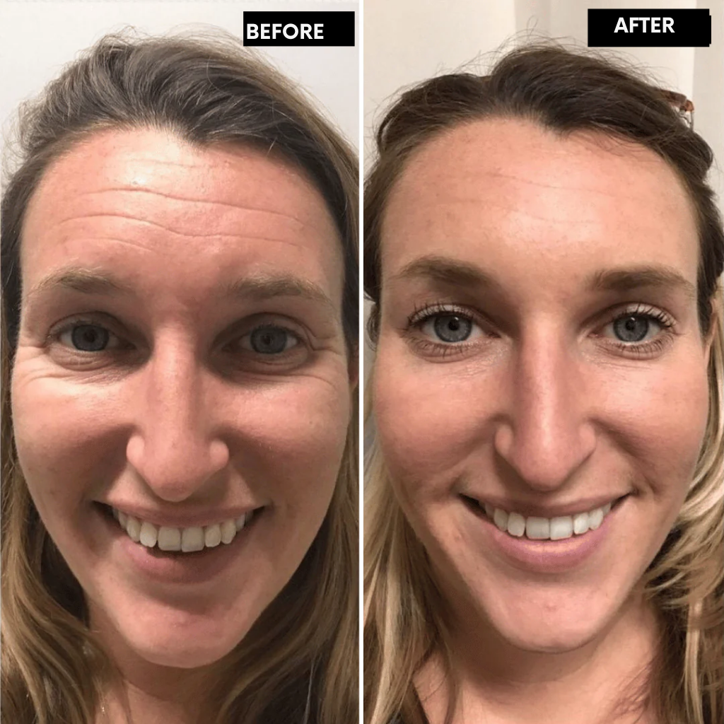 RadianceLift™ — Unleash Youthful Glow and Firm, Silky Skin in Just Two Weeks