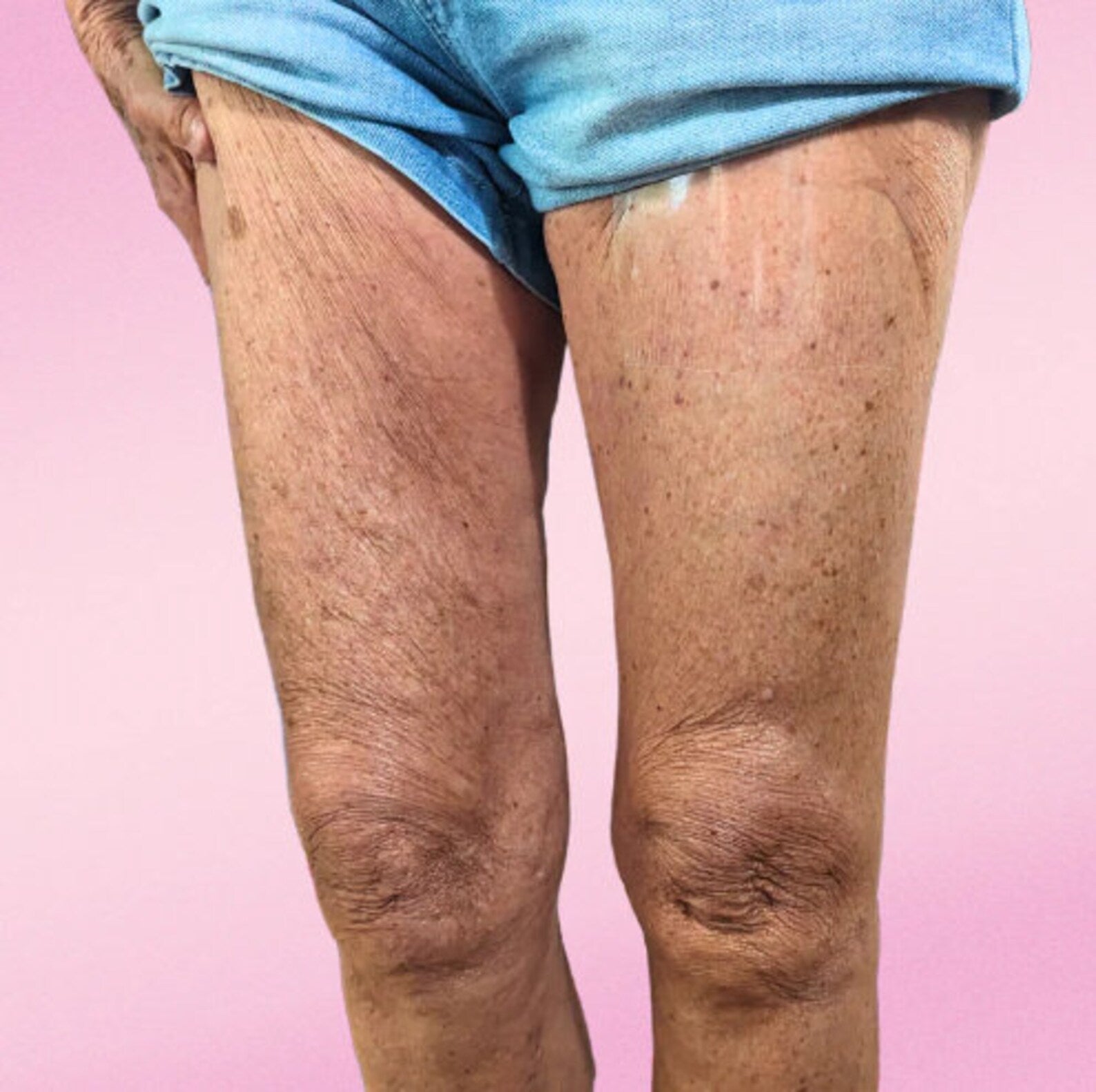 VeloraLift™ — Instant Invisible Lift for Skin That Feels Tight, Smooth, and Unstoppable