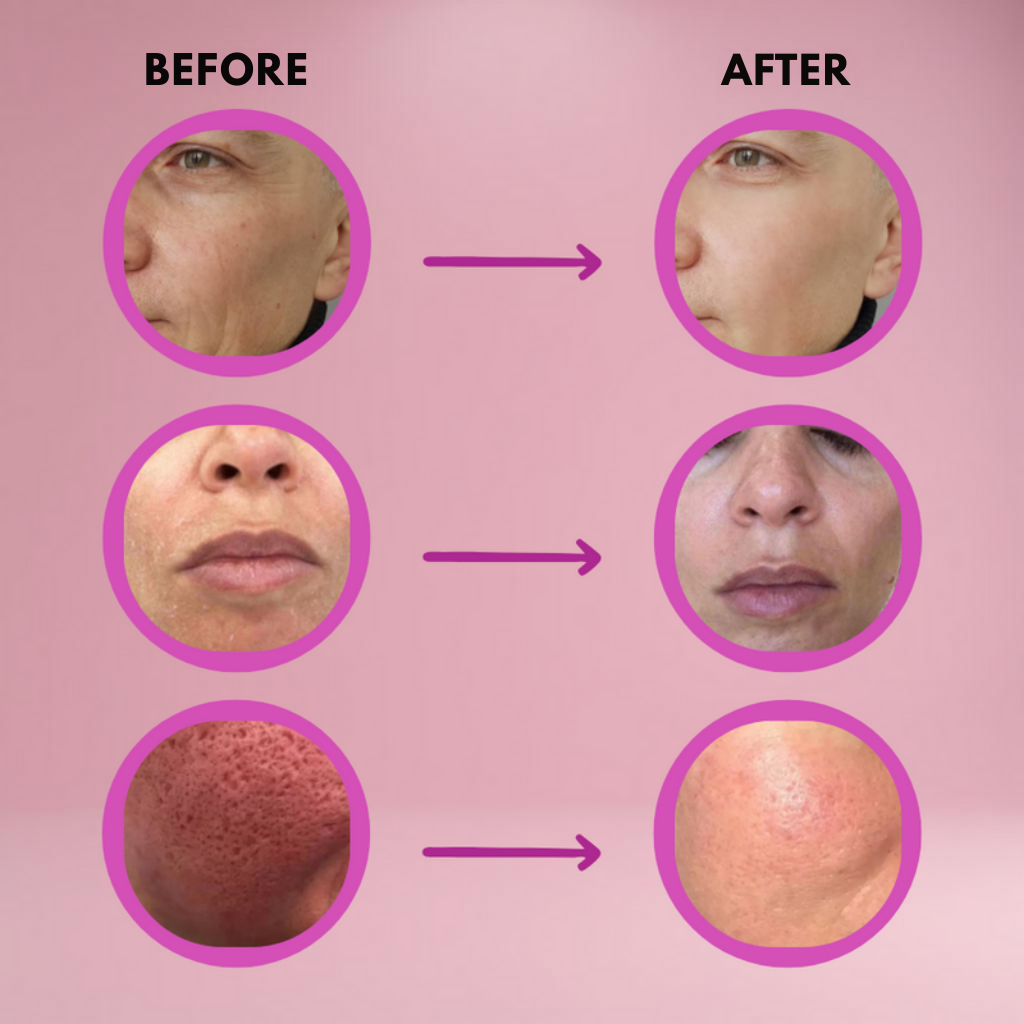VeluraMist™ — Watch Wrinkles Vanish Instantly for Skin That Shines Confidence