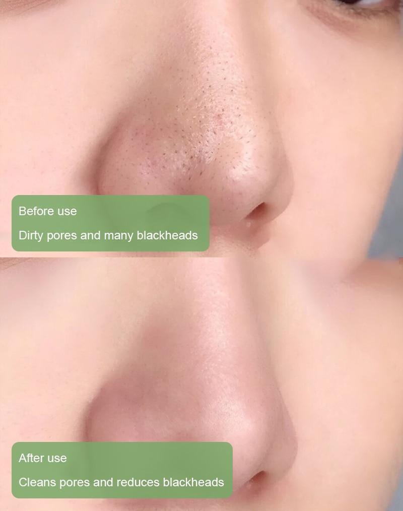 PoreVive™ Detox Mask Stick — Reveal Fresh, Shine-Free Skin That Commands Attention