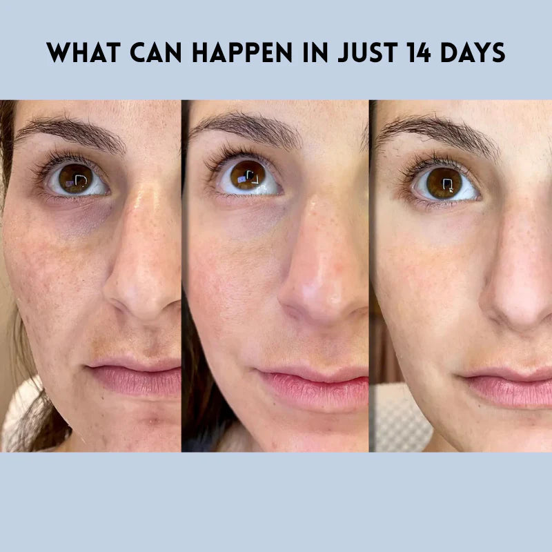 Skin Sculpting Strips™ — Instantly Lift, Smooth, and Radiate Your Ageless Glow