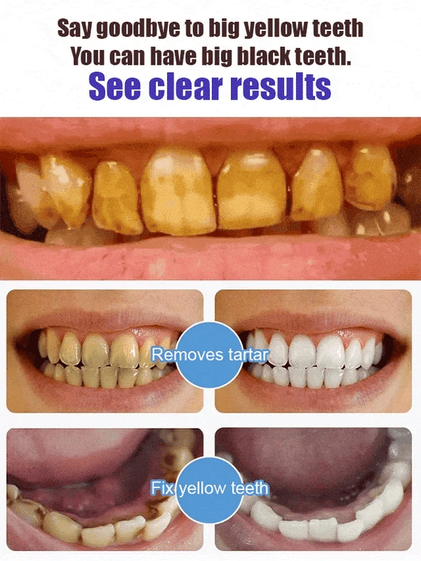BrightRise™ — Unlock a Cleaner, Whiter Smile That Commands Confidence Every Day