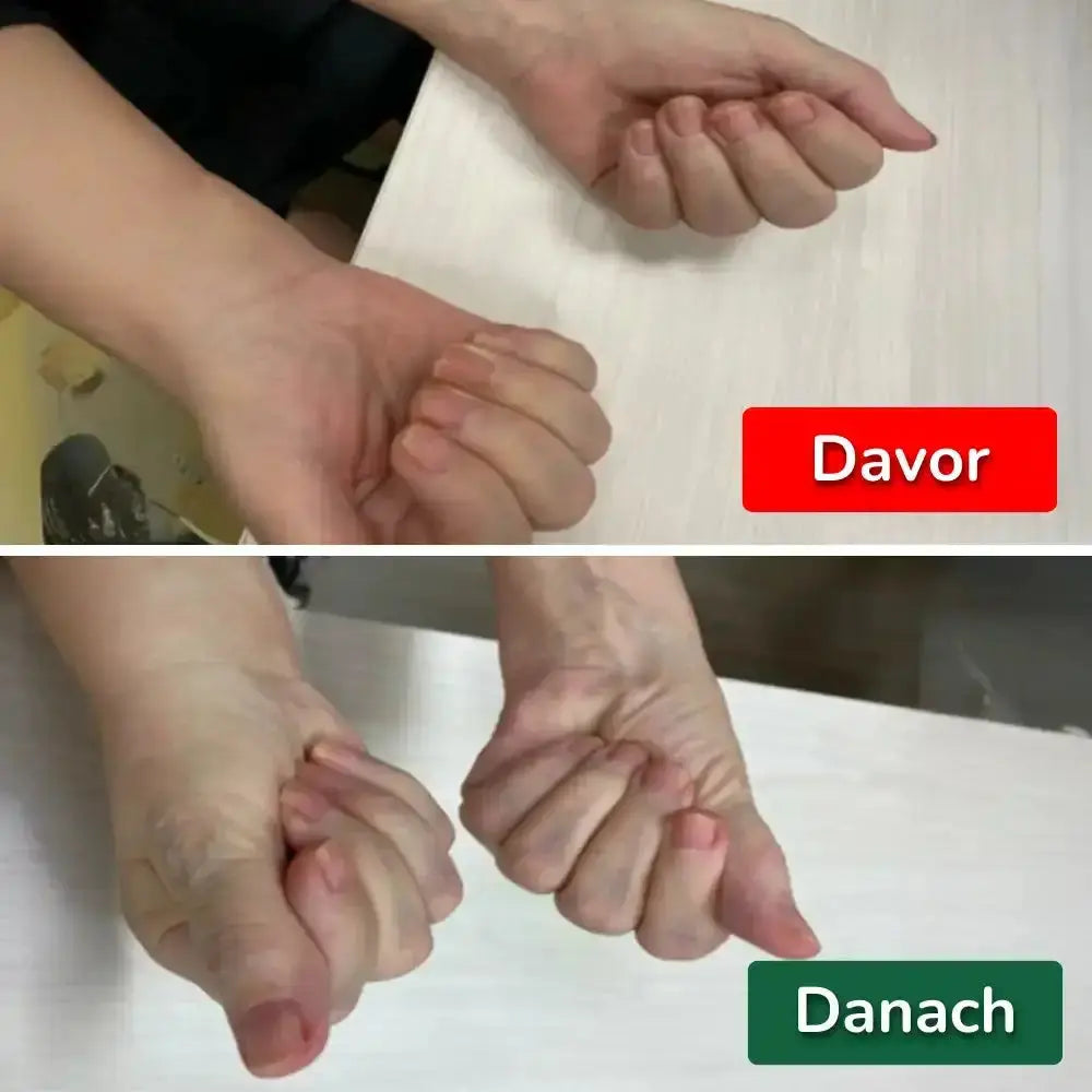 FlexaFree™ — Rediscover Pain-Free Wrists and Unstoppable Freedom to Move