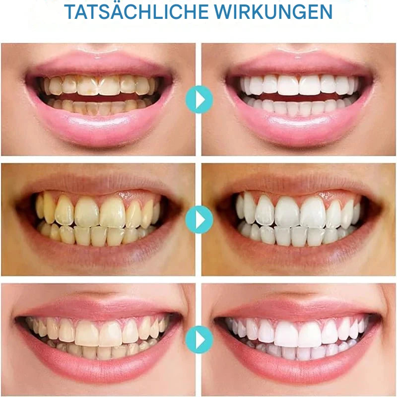 LumoraWhite™ — Transform Your Smile with Lasting Brightness and Fresh Confidence