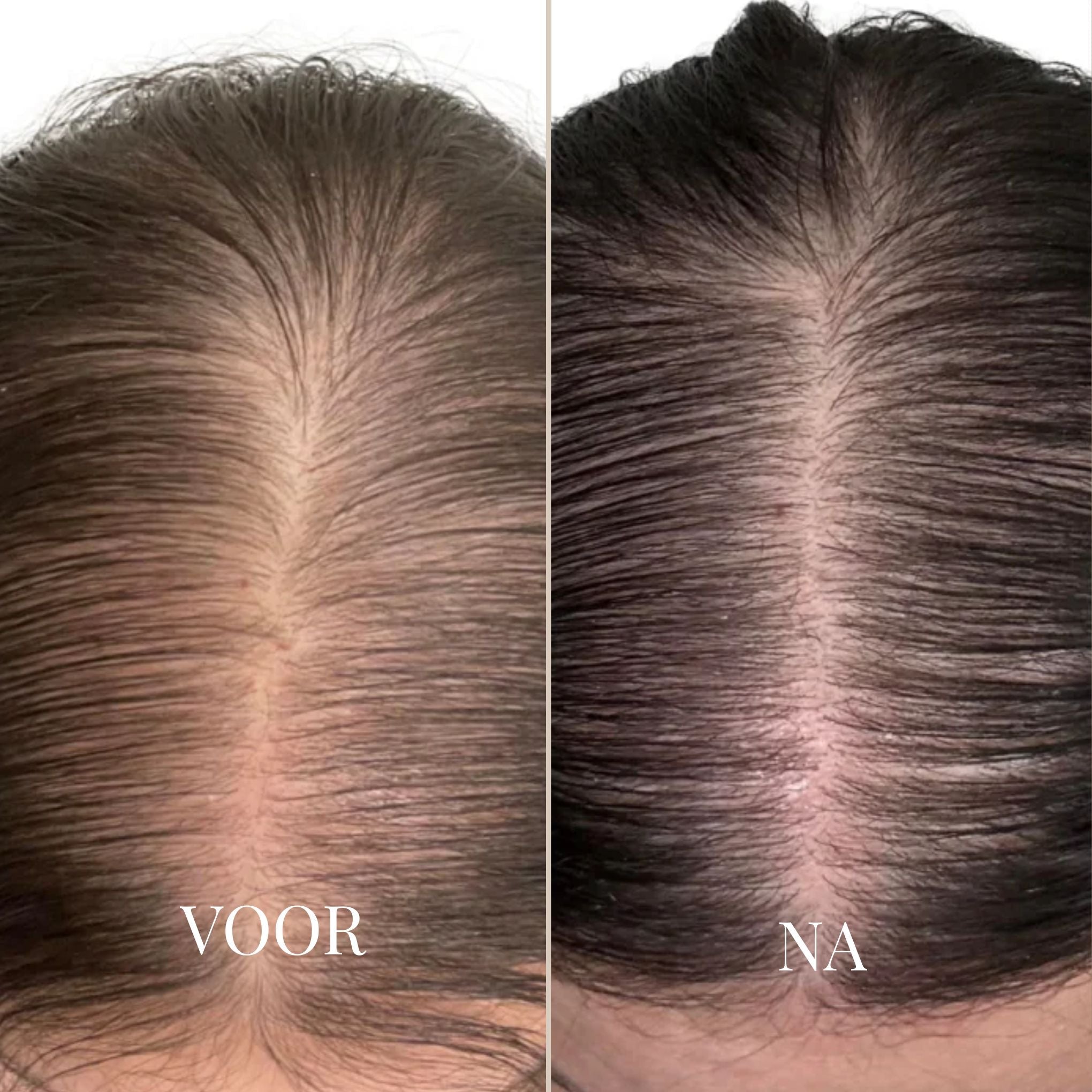 SilqueMist™ — Instantly Erase Grays and Own Every Moment with Flawless Hair Confidence